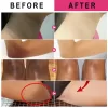Whitening Cream Quickly Private Parts Dark Skin Underarm Brightening - Image 2