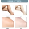Whitening Cream Skin Lightening Bleaching Cream Underarm Dark Skin - Image 5