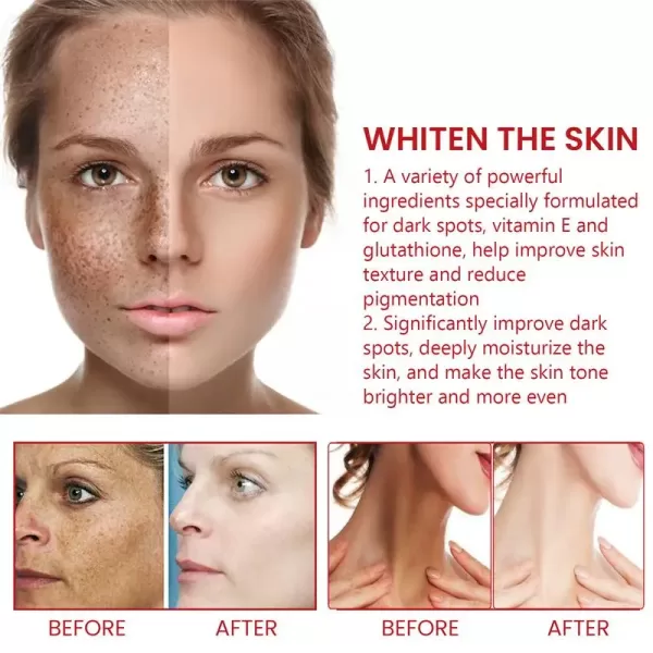 Powerful Dark Spot Remover Cream Whitening Body Lotion Lighten - Image 4
