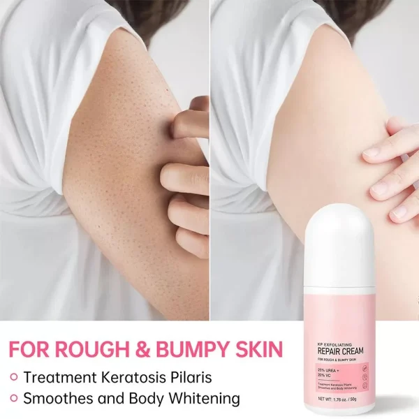 Body Cream Chicken Skin Removal Treatment Keratosis Lotion Pilaris Moisturizer Care