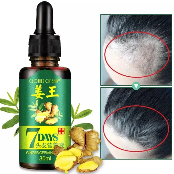 Hair Growth Germinal Serum Oil Natural Hair Treatment Effective Fast Growth Hair Care 30ML