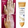Kojic Acid Whitening Hand Cream - Moisturizing & Brightening with Hyaluronic Acid, Glycerin & Vitamin E for Normal Skin