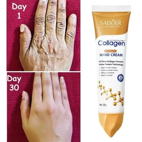 Kojic Acid Whitening Hand Cream – Moisturizing & Brightening with Hyaluronic Acid, Glycerin & Vitamin E for Normal Skin