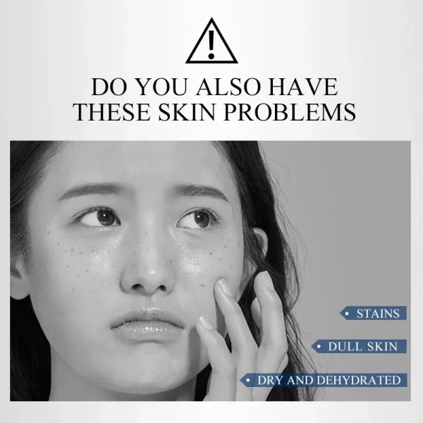 Whitening Cream Dark Spot Skin Whitening Fade Cream