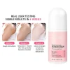 Body Cream Chicken Skin Removal Treatment Keratosis Lotion Pilaris Moisturizer Care - Image 3