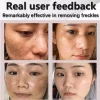Powerful Dark Spot Remover Cream Whitening Body Lotion Lighten - Image 2