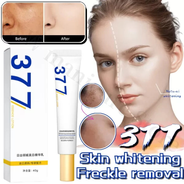 Whitening Removing Freckles Diluting Acne Spots Reducing Melanin Brightening Skin