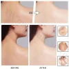 Whitening Removing Freckles Diluting Acne Spots Reducing Melanin Brightening Skin - Image 3