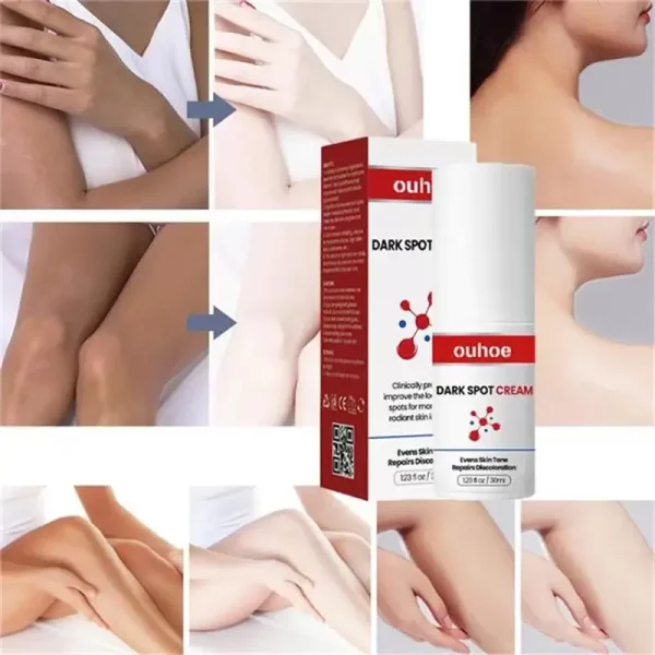 Powerful Dark Spot Remover Cream Whitening Body Lotion Lighten