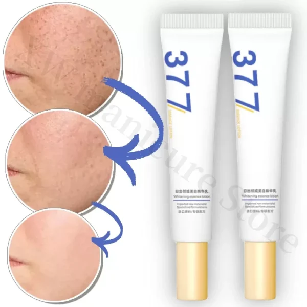Whitening Removing Freckles Diluting Acne Spots Reducing Melanin Brightening Skin