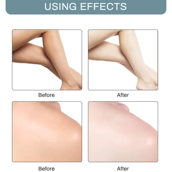 Whitening Cream Skin Lightening Bleaching Cream Underarm Dark Skin