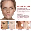 Powerful Dark Spot Remover Cream Whitening Body Lotion Lighten - Image 4