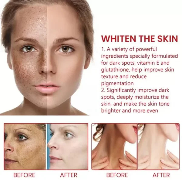 Powerful Dark Spot Remover Cream Whitening Body Lotion Lighten