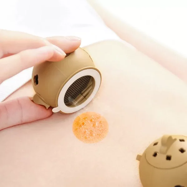 Portable Thermal Massager Mini Moxibustion Box Moxa Stick Burner Warm Cupping