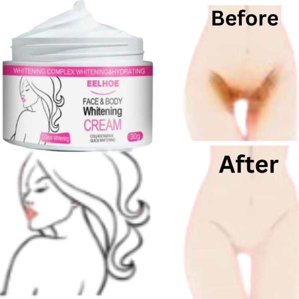 Whitening cream Using for Face,Body,Hand & Private Parts